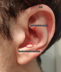 L-Ear_issue